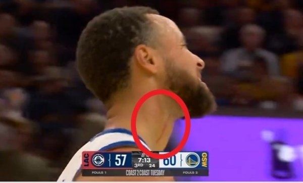 Curry: Vết máu là từ trận đấu 